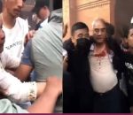 देउवा दम्पतीमाथि आक्रमणपछि अझै उपचारमा, कम्तिमा एक हप्ता अस्पतालमै बस्ने