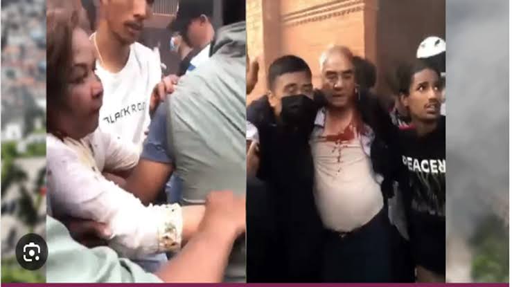 देउवा दम्पतीमाथि आक्रमणपछि अझै उपचारमा, कम्तिमा एक हप्ता अस्पतालमै बस्ने